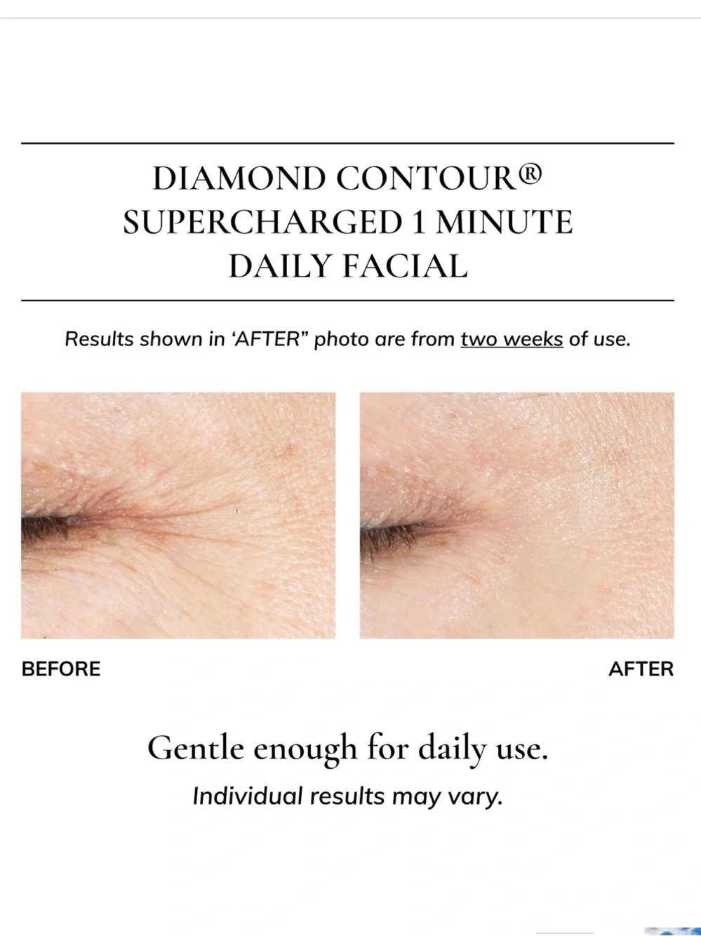 Kaplan MD Diamond Contour Supercharged 1 Minute Daily Facial 6oz/180ml